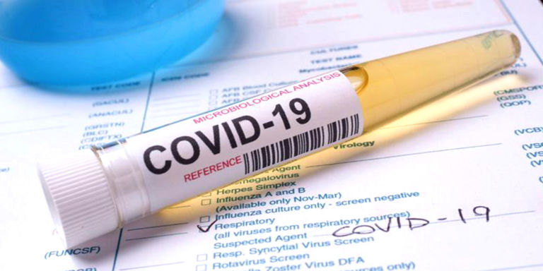 Sign up to the government’s free COVID-19 workplace testing programme